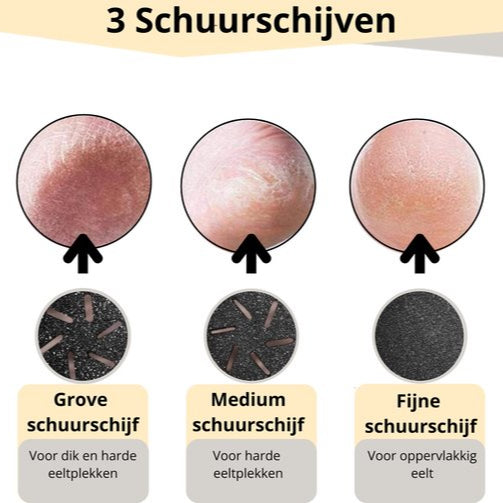 3 Vijlschijven - Grof, Medium en Fijn