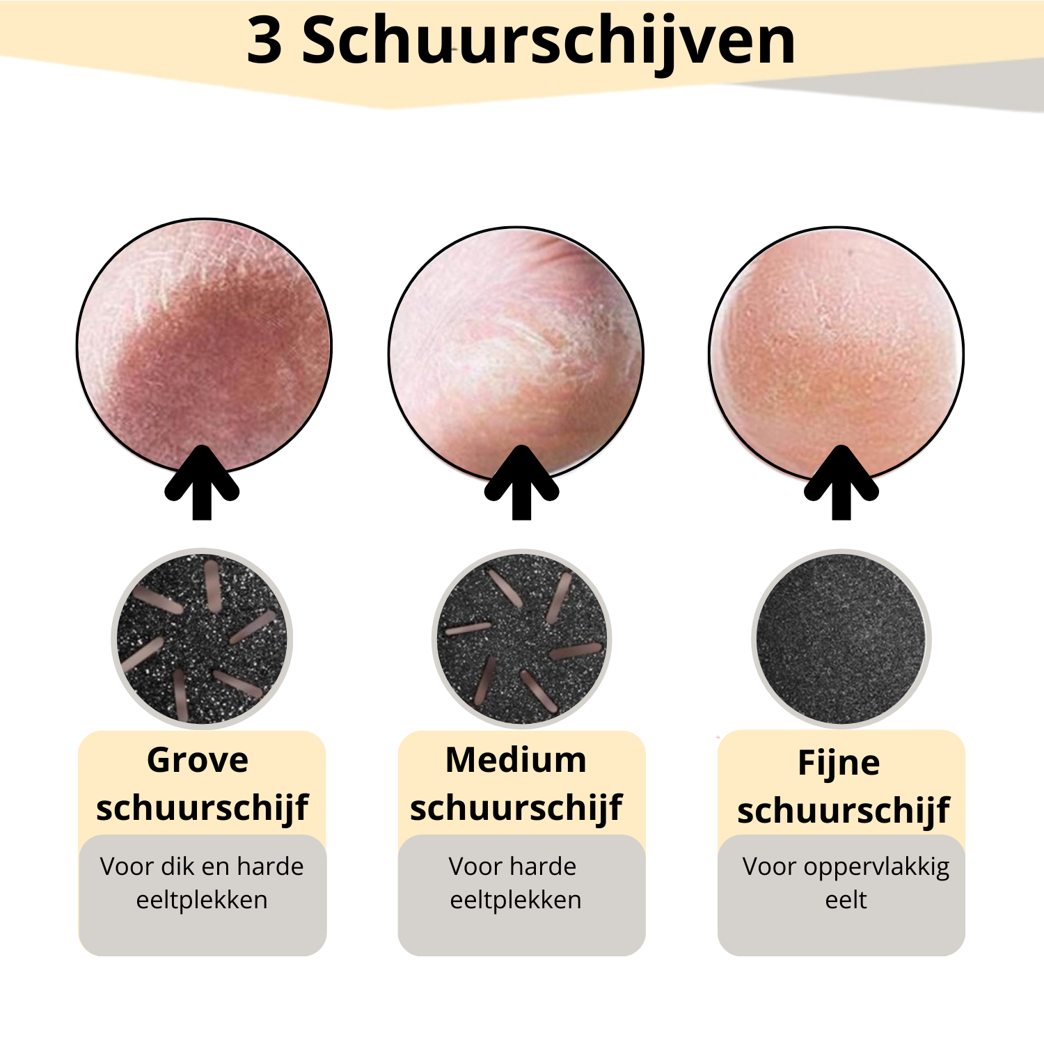 Overzicht van grove, medium en fijne schuurschijf – voor verschillende soorten eeltplekken